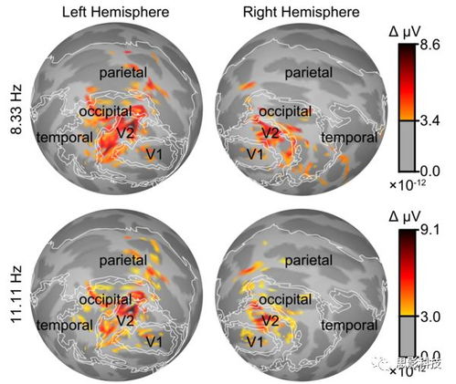 脑磁图（MEG）数据处理 思影数据处理服务六的专业解决方案